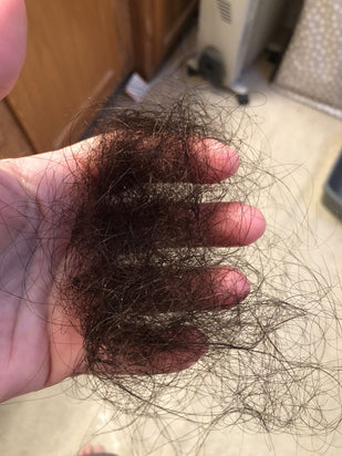 Your hair keeps thinning out, even after trying every product on the shelf.