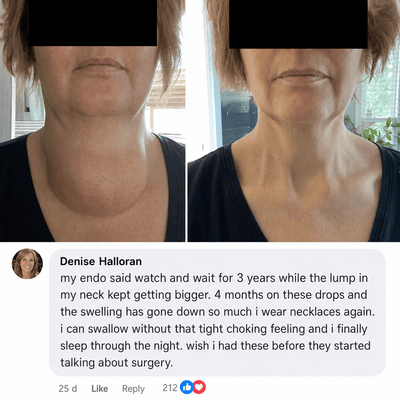 Actora Thyroid Support Drops Goiter