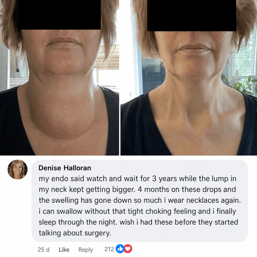 Actora Thyroid Support Drops Goiter