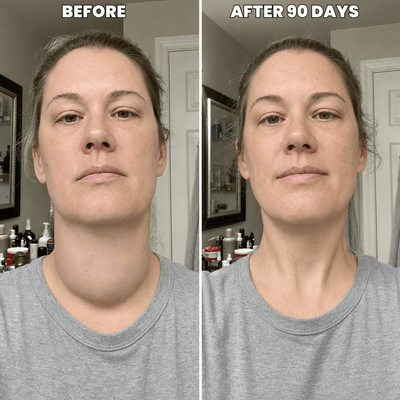 Actora Thyroid Support Drops Goiter