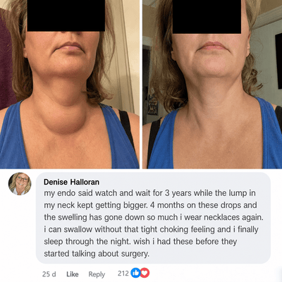 Actora Thyroid Support Drops Goiter