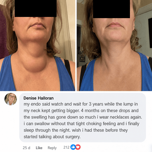 Actora Thyroid Support Drops Goiter